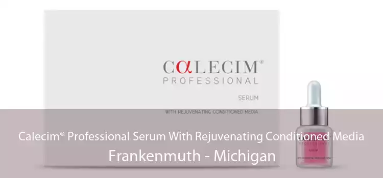 Calecim® Professional Serum With Rejuvenating Conditioned Media Frankenmuth - Michigan