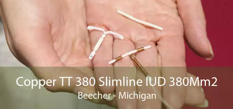 Copper TT 380 Slimline IUD 380Mm2 Beecher - Michigan