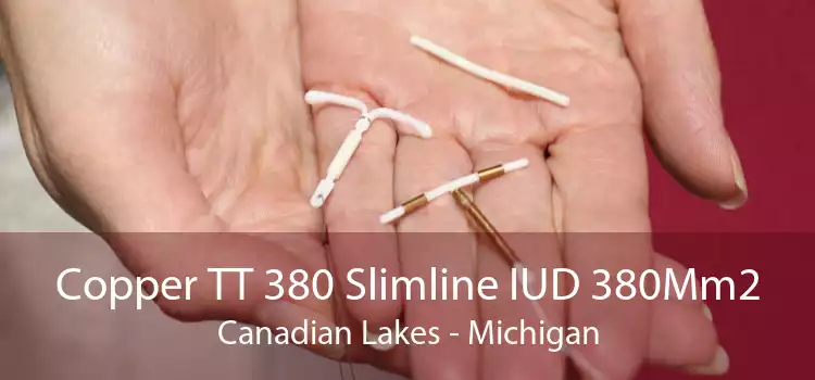 Copper TT 380 Slimline IUD 380Mm2 Canadian Lakes - Michigan
