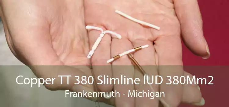 Copper TT 380 Slimline IUD 380Mm2 Frankenmuth - Michigan