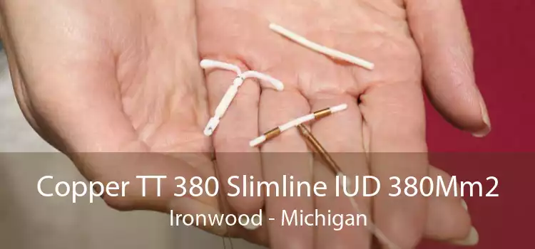 Copper TT 380 Slimline IUD 380Mm2 Ironwood - Michigan