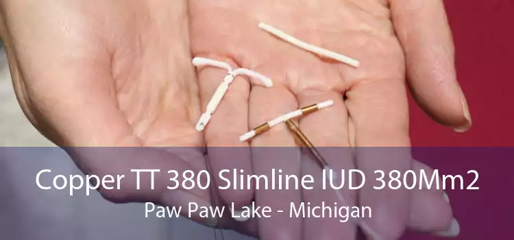 Copper TT 380 Slimline IUD 380Mm2 Paw Paw Lake - Michigan