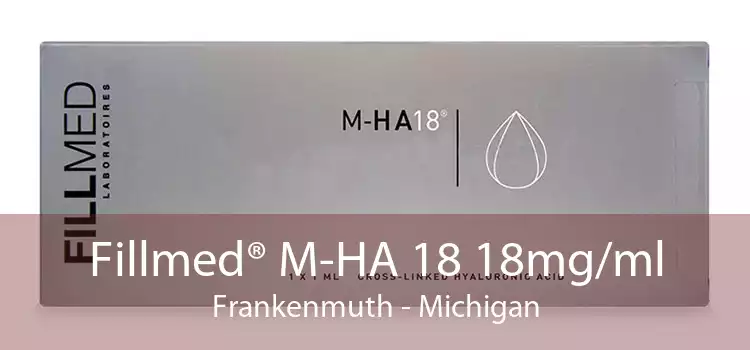 Fillmed® M-HA 18 18mg/ml Frankenmuth - Michigan