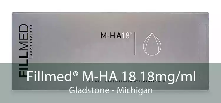 Fillmed® M-HA 18 18mg/ml Gladstone - Michigan
