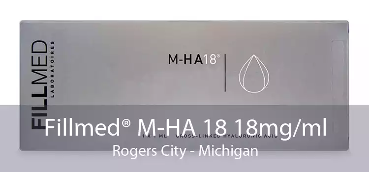 Fillmed® M-HA 18 18mg/ml Rogers City - Michigan