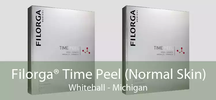 Filorga® Time Peel (Normal Skin) Whitehall - Michigan