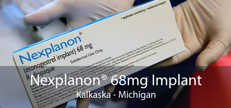 Nexplanon® 68mg Implant Kalkaska - Michigan