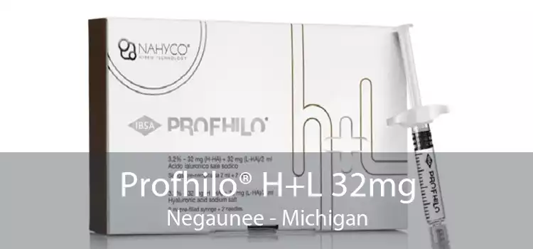 Profhilo® H+L 32mg Negaunee - Michigan