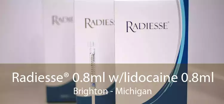 Radiesse® 0.8ml w/lidocaine 0.8ml Brighton - Michigan