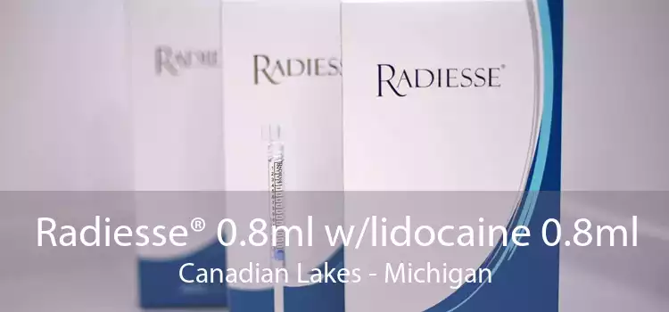 Radiesse® 0.8ml w/lidocaine 0.8ml Canadian Lakes - Michigan