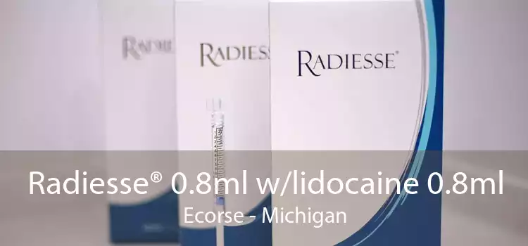 Radiesse® 0.8ml w/lidocaine 0.8ml Ecorse - Michigan