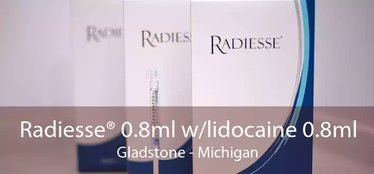 Radiesse® 0.8ml w/lidocaine 0.8ml Gladstone - Michigan