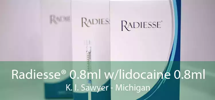 Radiesse® 0.8ml w/lidocaine 0.8ml K. I. Sawyer - Michigan