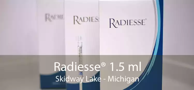 Radiesse® 1.5 ml Skidway Lake - Michigan