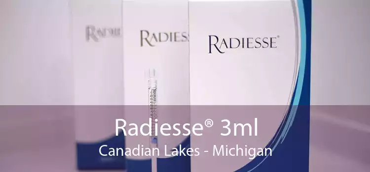 Radiesse® 3ml Canadian Lakes - Michigan