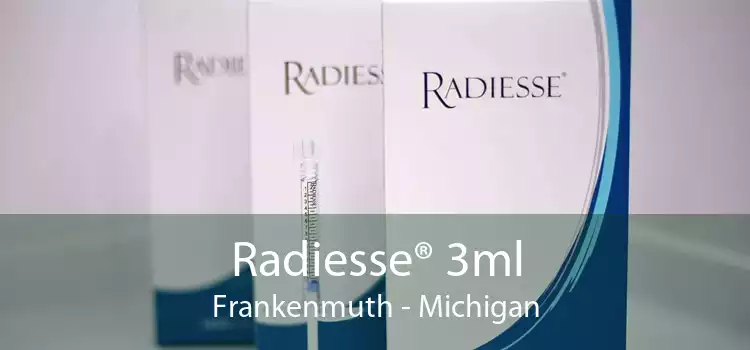 Radiesse® 3ml Frankenmuth - Michigan
