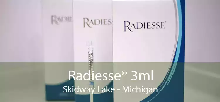 Radiesse® 3ml Skidway Lake - Michigan