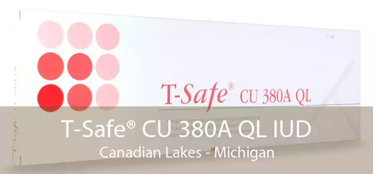 T-Safe® CU 380A QL IUD Canadian Lakes - Michigan
