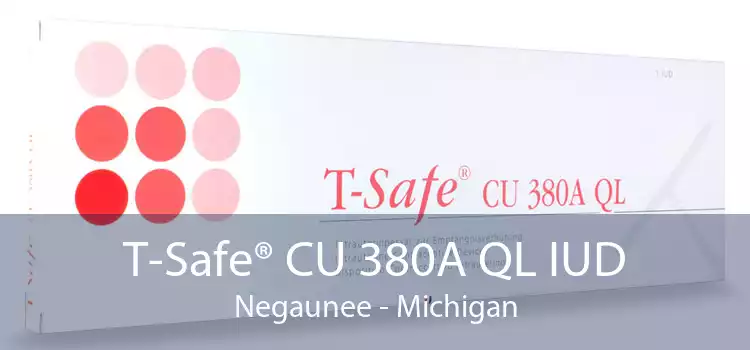 T-Safe® CU 380A QL IUD Negaunee - Michigan
