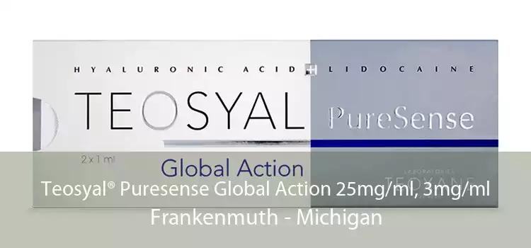 Teosyal® Puresense Global Action 25mg/ml, 3mg/ml Frankenmuth - Michigan