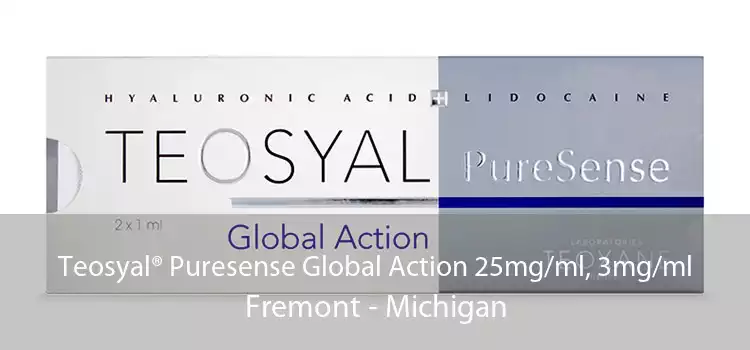 Teosyal® Puresense Global Action 25mg/ml, 3mg/ml Fremont - Michigan