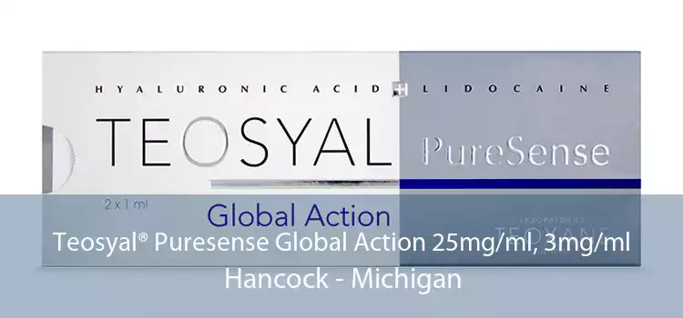 Teosyal® Puresense Global Action 25mg/ml, 3mg/ml Hancock - Michigan
