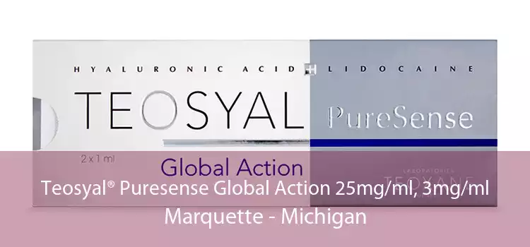 Teosyal® Puresense Global Action 25mg/ml, 3mg/ml Marquette - Michigan