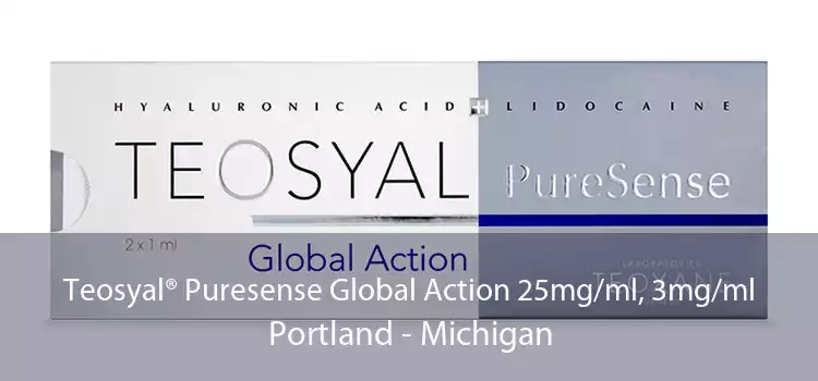 Teosyal® Puresense Global Action 25mg/ml, 3mg/ml Portland - Michigan