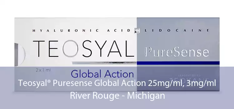 Teosyal® Puresense Global Action 25mg/ml, 3mg/ml River Rouge - Michigan