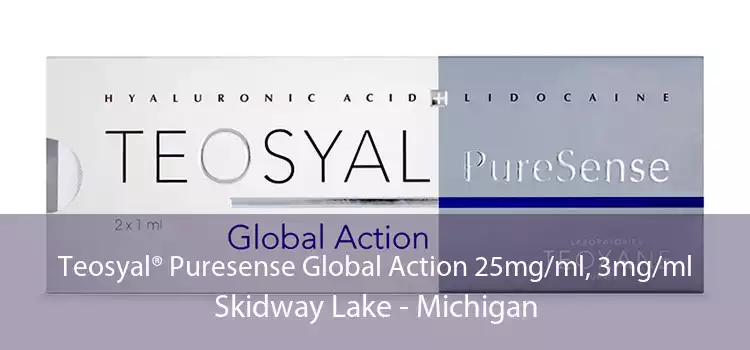 Teosyal® Puresense Global Action 25mg/ml, 3mg/ml Skidway Lake - Michigan
