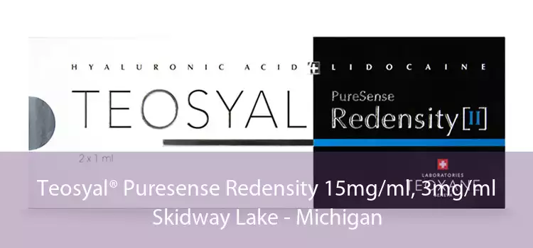 Teosyal® Puresense Redensity 15mg/ml, 3mg/ml Skidway Lake - Michigan
